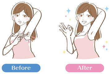 ワキ　ムダ毛　脱毛　セット