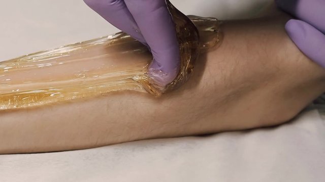 sugaring depilation hot sugar paste hair on female hand in professional beauty salon