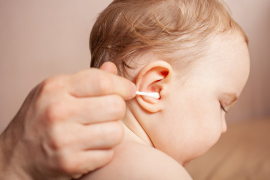 
Dad Is Cleaning His Daughter’s Ears. Cotton Bud In A Children's Ear. Male Hands Hold Cotton Wool And Clean The Ear Of The Child.