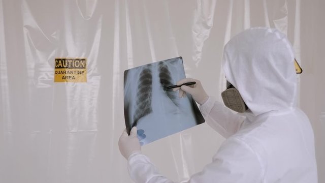 Close-up of a doctor in a protective suit studying an x-ray of a patient's chest in the clinic, he makes notes on the foci of inflammation of the new COVID-19 virus. Quarantine, coronavirus.