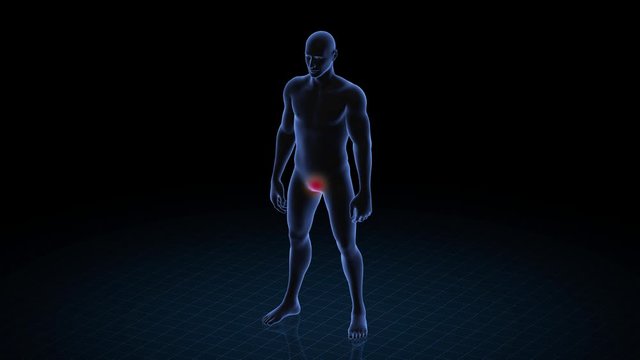 Man with pathology. 3d body of boy. Male human figure.