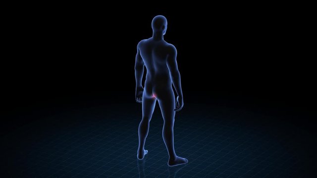 Man with pathology. 3d body of boy. Male human figure.