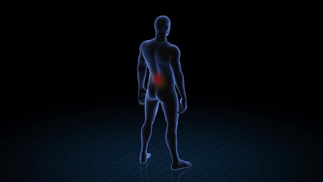 Man with pathology. 3d body of boy. Male human figure.