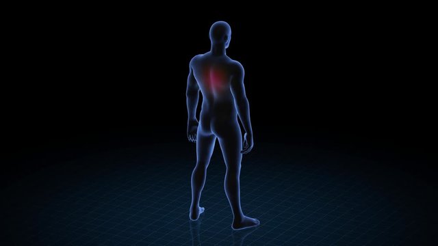 Man with pathology. 3d body of boy. Male human figure.