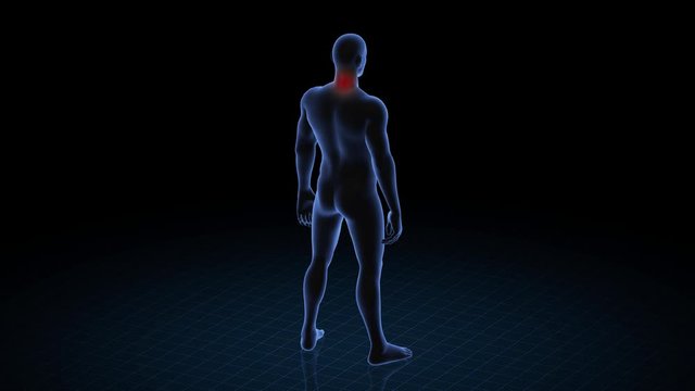 Man with pathology. 3d body of boy. Male human figure.