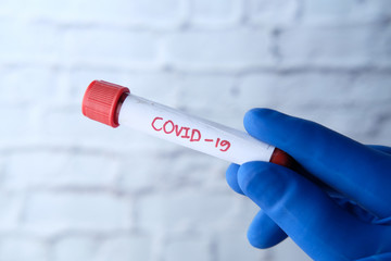 laboratory technician testing corona virus , COVID 19 test.