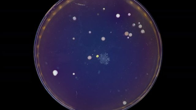 mushroom mycelium growth in petri dish time lase on MacConkey agar