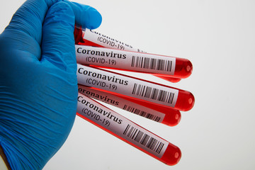 Coronavirus Blood Test in Laboratory
