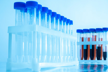 Plastic test tubes for laboratory tests. Collection of blood tests. Medical research of biological...