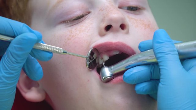 Closeup of female dentist treating little boy in dental clinic. Pediatric dentistry