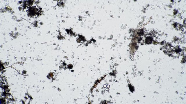 Life of rotifers in dirty environment of microscopic background. Theme of laboratory biological research under microscope. Microscopic protozoa in drop of water magnification. Microcosmic background