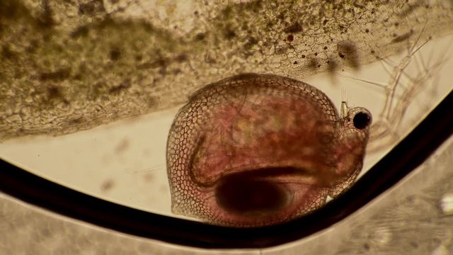 Daphnia crustacean moves its legs under a microscope. Theme of laboratory biological research under microscope. Microscopic protozoa in drop of water magnification. Microcosmic background