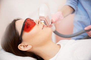 Removal of unwanted hair laser on face mustache young woman. Concept beauty and health