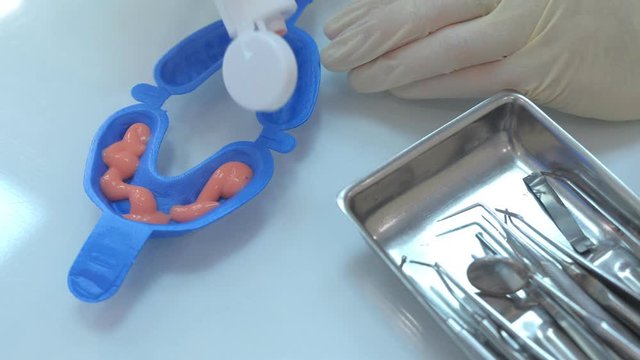Dentist is putting fluoride gel in mouth guard in stomatology clinic, hands closeup. Procedure for fluoridation of teeth in dentistry. Stomatologist hygienists preparing materials to treatment.