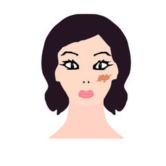 Pigmentation on the skin. A pigmented spot on the skin of the face. Vector illustration
