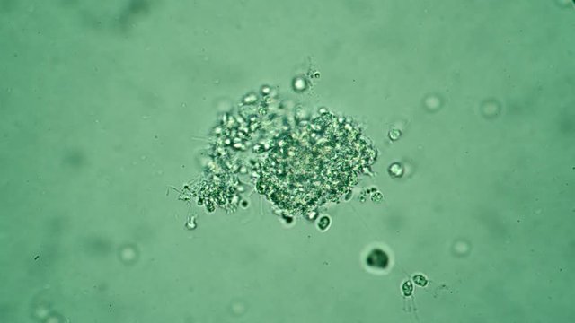 Green algae inhabited by protozoa microorganisms and bacteria. Theme of laboratory biological research under microscope. Microscopic protozoa in a drop magnification. Microcosm background.