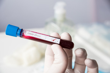 Obraz premium test tube, inscription virus, coronavirus study, virus research