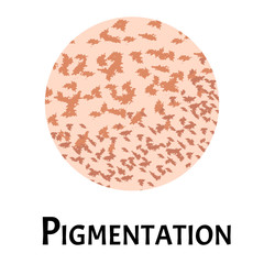 Pigmentation on the skin. A pigmented spot on the skin of the face. Vector illustration
