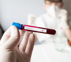 Obraz premium test tube, inscription virus, coronavirus study, virus research