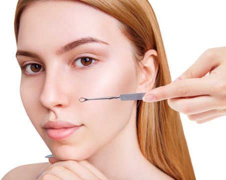 Young woman with acne loop. Squeeze the acne with acne spoon.
