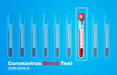Coronavirus Blood Test. Realistic 3D test tube with blood. Coronavirus (2019-nCoV) background. Virus Covid 19-NCP. Coronavirus nCoV. Positive and negative testing for COVID.
