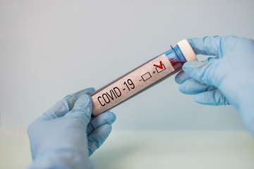 Obraz premium blood test coronavirus test in test tube with the result in the hands of a doctor of a virologist with medical gloves