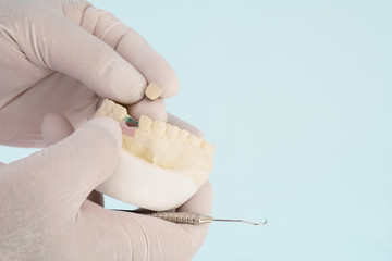 Prosthodontics or Prosthetic / Crown and bridge equipment and model express fix restoration.