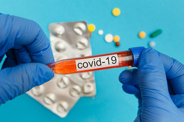 Test tube with blood sample for COVID-19 test, novel coronavirus 2019