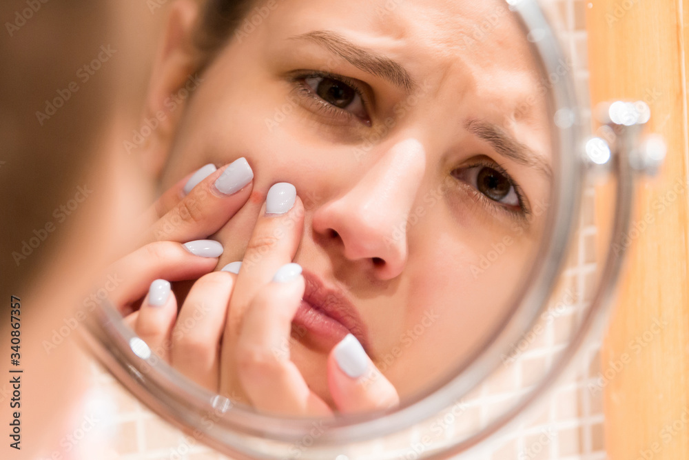 Wall mural young girl squeezes pimple on the fer face in front of a bathroom mirror. beauty skincare and wellne