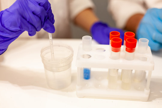 hands in protective gloves work with laboratory test tubes and other equipment