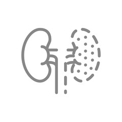 Kidneys amputation line icon. Nephrectomy, one kidney symbol