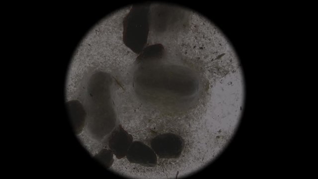 Microscopic view of dirt and dust from the street, microbes