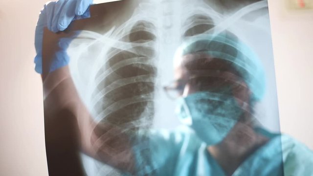 Conceptual video of a doctor holding and analyzing an x-ray of some lungs.