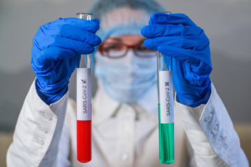 Positive and negative blood test results for SARS-CoV-2, coronavirus causing CONVID-19 disease