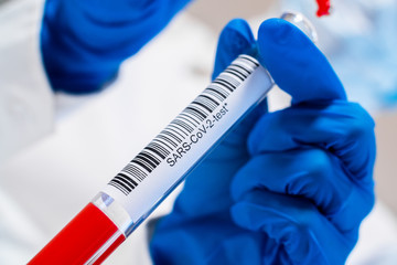 Test tube with SARS-CoV-2 in the hands, coronavirus COVID-19