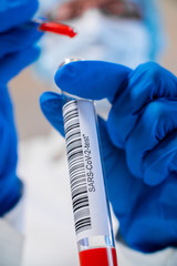 Test tube with SARS-CoV-2 in the hands, coronavirus COVID-19