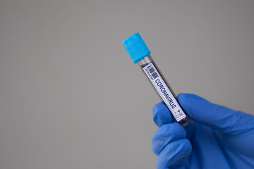 Obraz premium Blood sample of coronavirus test made in the world pandemic in 2020. Laboratory assistant holding blood sample for covid-19 test.