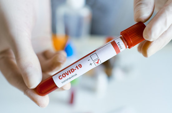 Covid 19 Infected Blood Sample In Medical Test Tube In Hand Of Scientist.