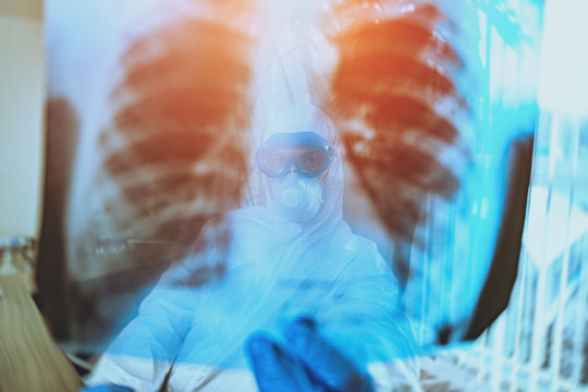 close-up of x-ray