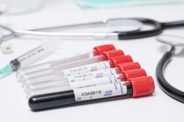 Coronavirus 2019-nCoV Blood Sample. blood for corona, covid-19 virus examination, collected to do a battery of laboratory tests.