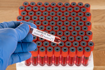 Fototapeta premium Covid-19 blood samples
