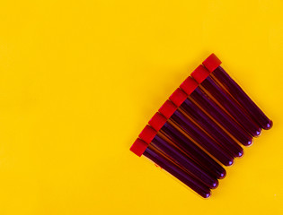 Test tubes containing a blood test samples