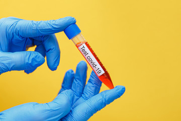 Test tube with blood sample for COVID-19 test
