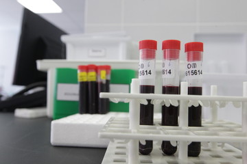 A row of human blood samples in a medical laboratory ready to be tested. 