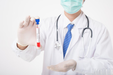 Doctor is holding infected  covid-19  blood test  on white Background