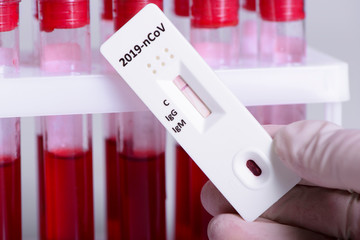 Rapid Covid-19 coronavirus strip test cassette for antibody or sars-cov-2 virus disease in hand and blood test tube epidemic concept background close-up