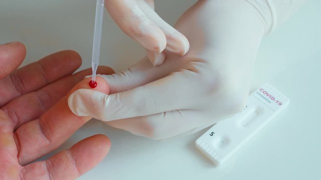 scientist in laboratory squeezes blood from a patient finger and draws it into a pipette for blood samlping to rapid test for viral disease coronavirus