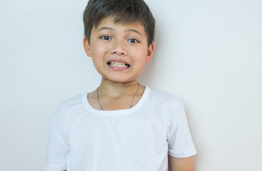 Asian boy smile with decay teeth.
