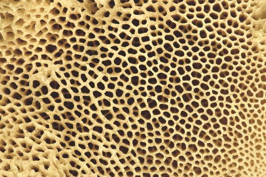 Bone structure. Bone tissue close-up. Osteoporosis.