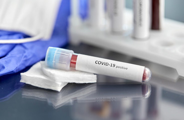 medicine, healthcare and pandemic concept - close up of beaker with coronavirus blood test on table...